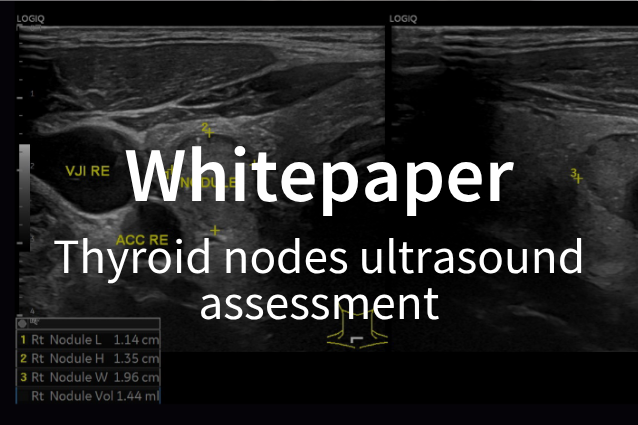 Whitepaper / Thyroid nodes ultrasound assessment